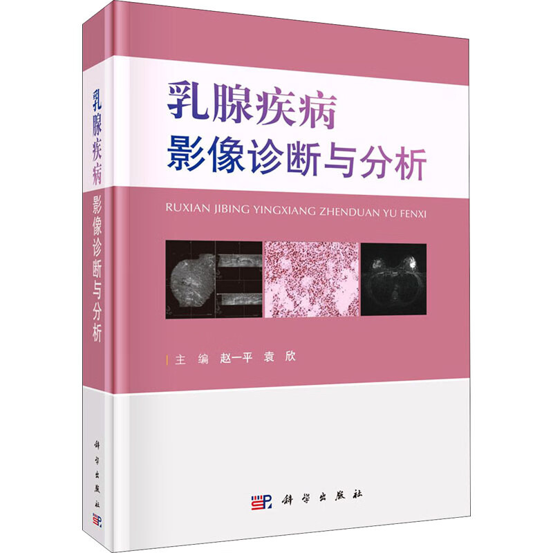乳腺疾病影像诊断与分析