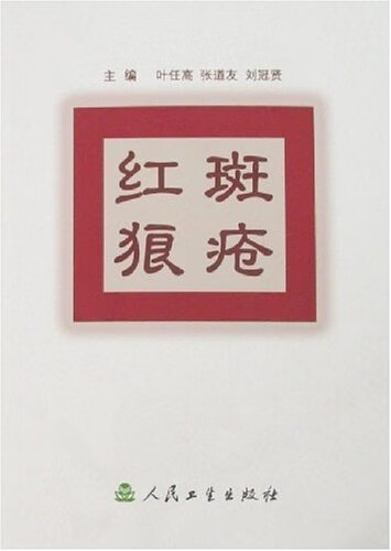 红斑狼疮