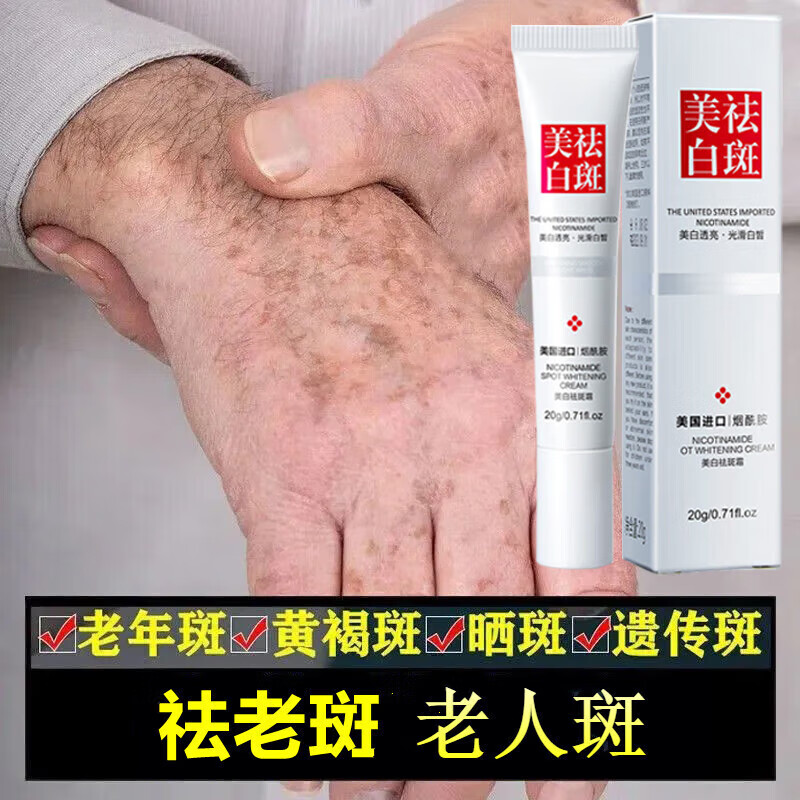 氢醌乳膏 黄褐斑 祛斑霜祛老年斑去雀斑官方品正手部脸部手背专用的药强力去除 一支装