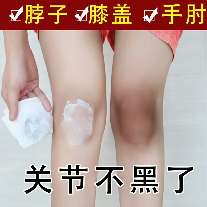 黑脖子胳膊肘腋下手肘膝盖私处大腿内侧黑脖子黑黑的黑棘皮症皮肤黑