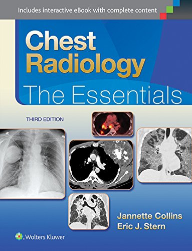 预订 chest radiology: the essentials (essentials series)