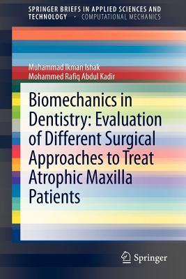 预订Biomechanics in Dentistry: Evaluation of Differe