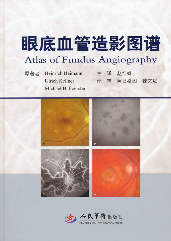 眼底血管造影图谱