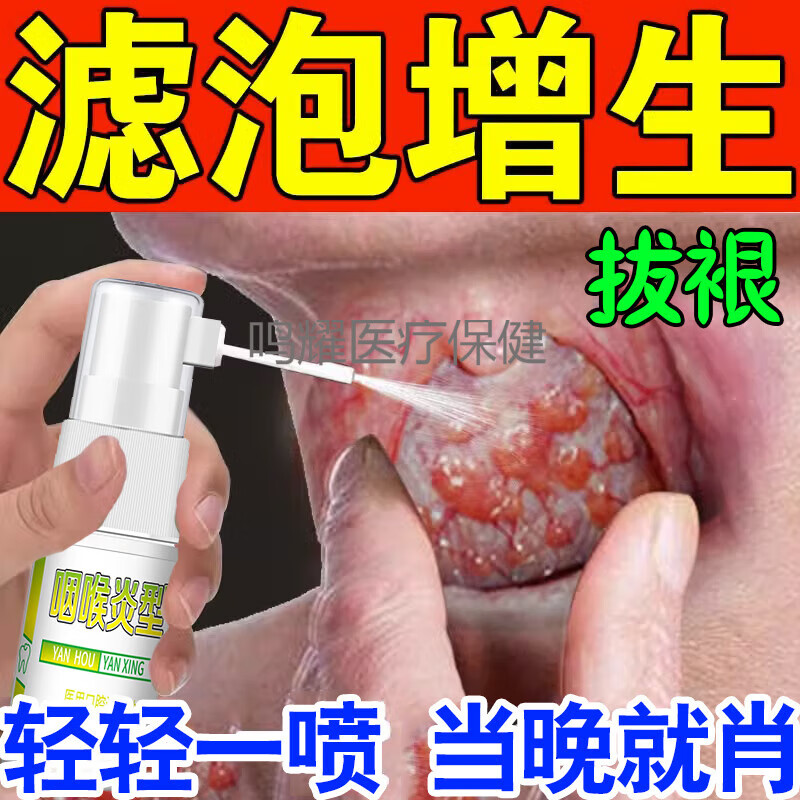 咽炎慢性咽炎除i根特i效药喷雾剂根i治滤泡增生喉咙有痰 一盒装能用二
