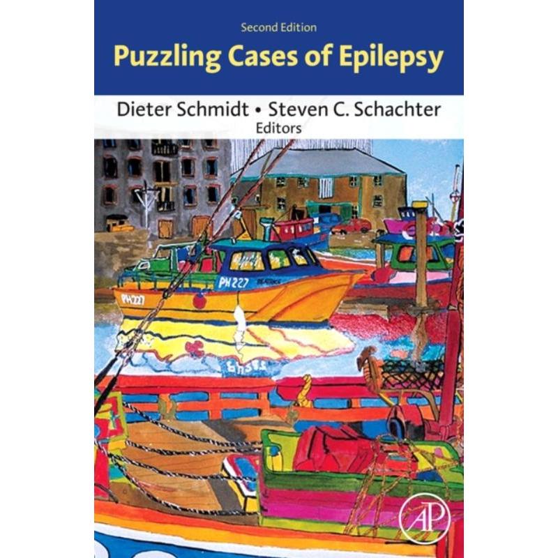 预订puzzling cases of epilepsy
