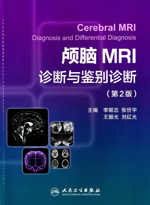 颅脑MRI诊断与鉴别诊断(第2版)【正版图书】