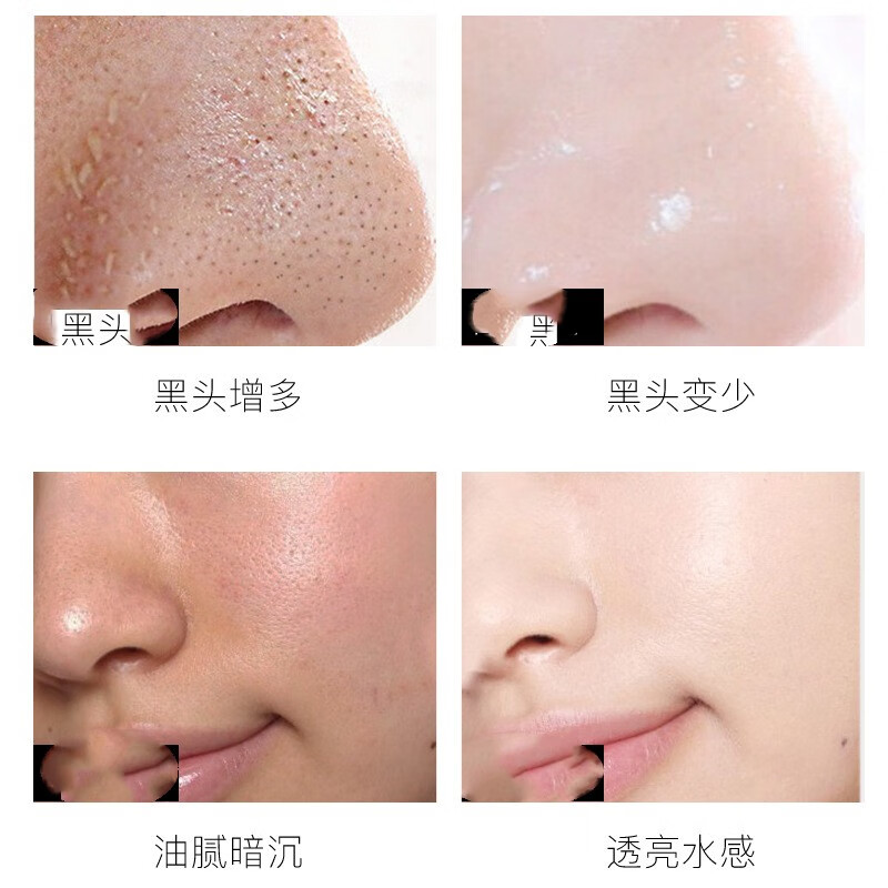 约肤净化平衡按摩膏美颜脸部按摩膏黑头提拉深层清洁男女士抖音同款佰