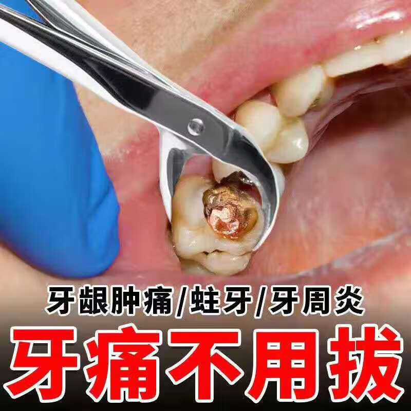 牙洞牙膏牙体硬组织感染牙洞龋齿烂牙虫牙牙缝宽大