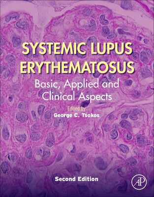 【预订】systemic lupus erythematosus