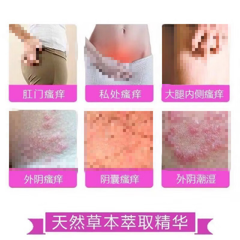 百养灵阴痒王女性外阴私处瘙痒痒膏去痒根红肿刺痛白斑炎乳膏 买5+4【九盒装】