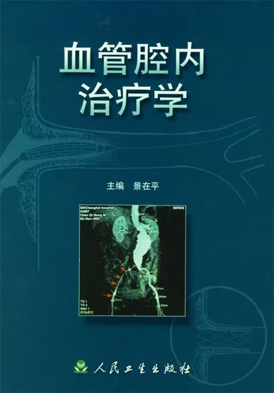 血管腔内治疗学