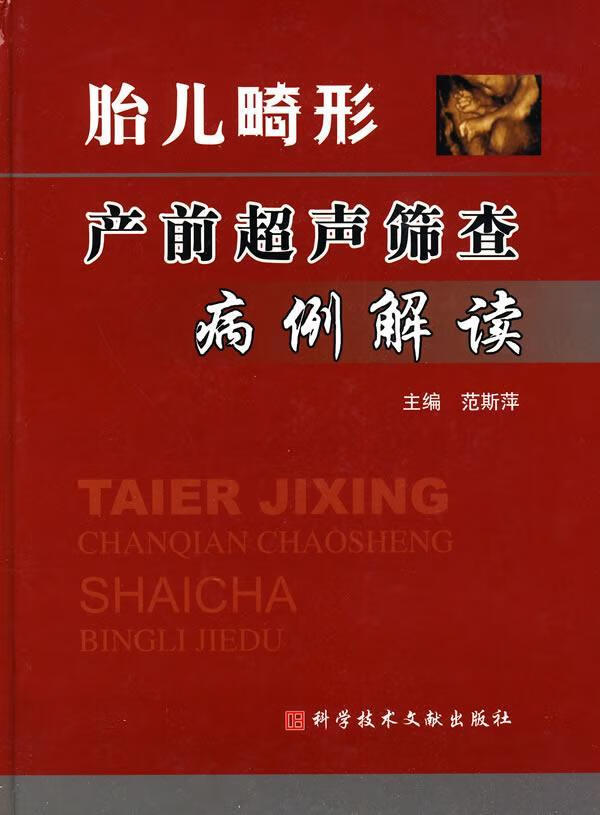 胎儿畸形产前超声筛查病例解读/范斯萍/医
