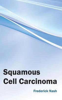 预订Squamous Cell Carcinoma
