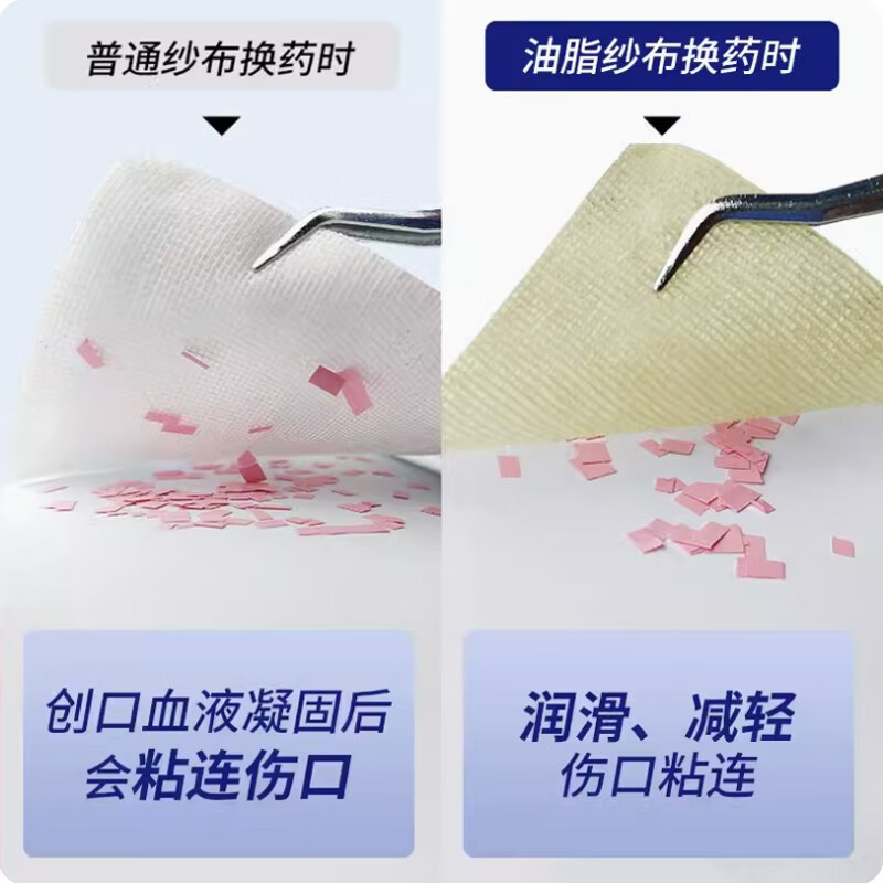 一次性医用油脂纱布块烧烫伤口包扎敷料无菌润滑防粘 【1盒】8cm*10cm*8层（60片独立装）