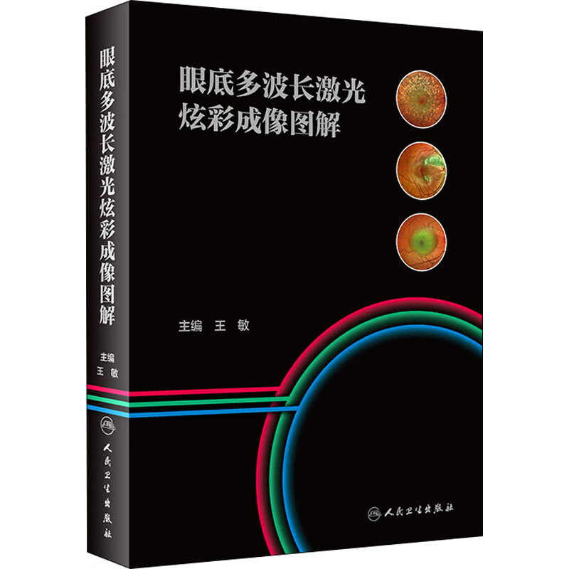 眼底多波长激光炫彩成像图解