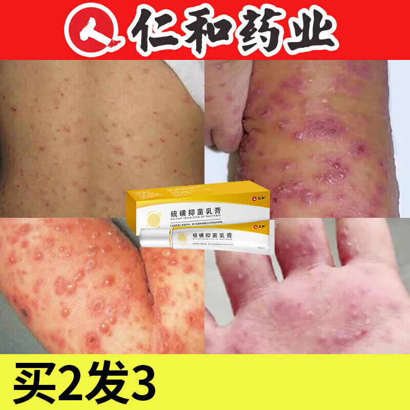 仁和乳膏男可搭百部酊10%去疮疥阴虱螨虫阴囊结节疥虫外用皮肤瘙痒膏