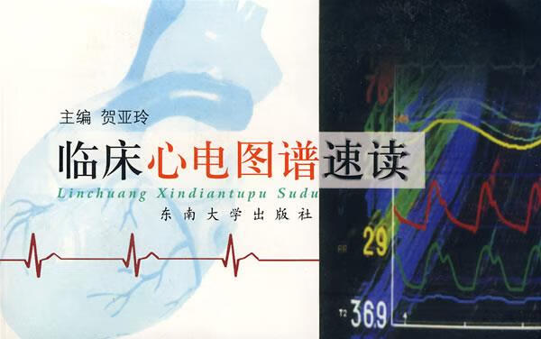 临床心电图谱速读