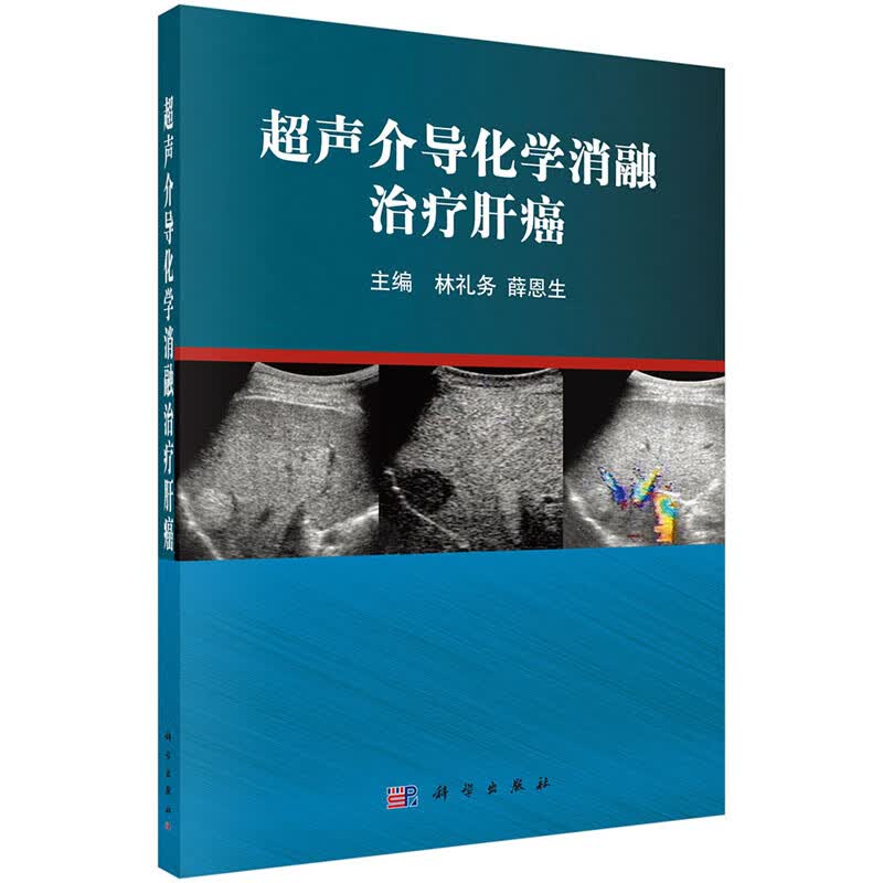超声介导化学消融治疗肝癌