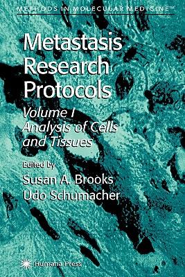 预订Metastasis Research Protocols