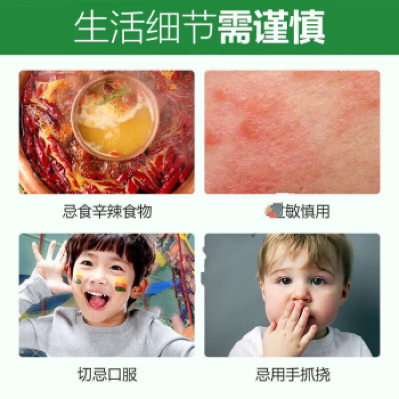 澳德力康嘴角溃烂软膏口角炎修复膏烂嘴角秋冬干裂开裂起泡溃烂疼痛红肿发 买3+2【五盒巩固装】，