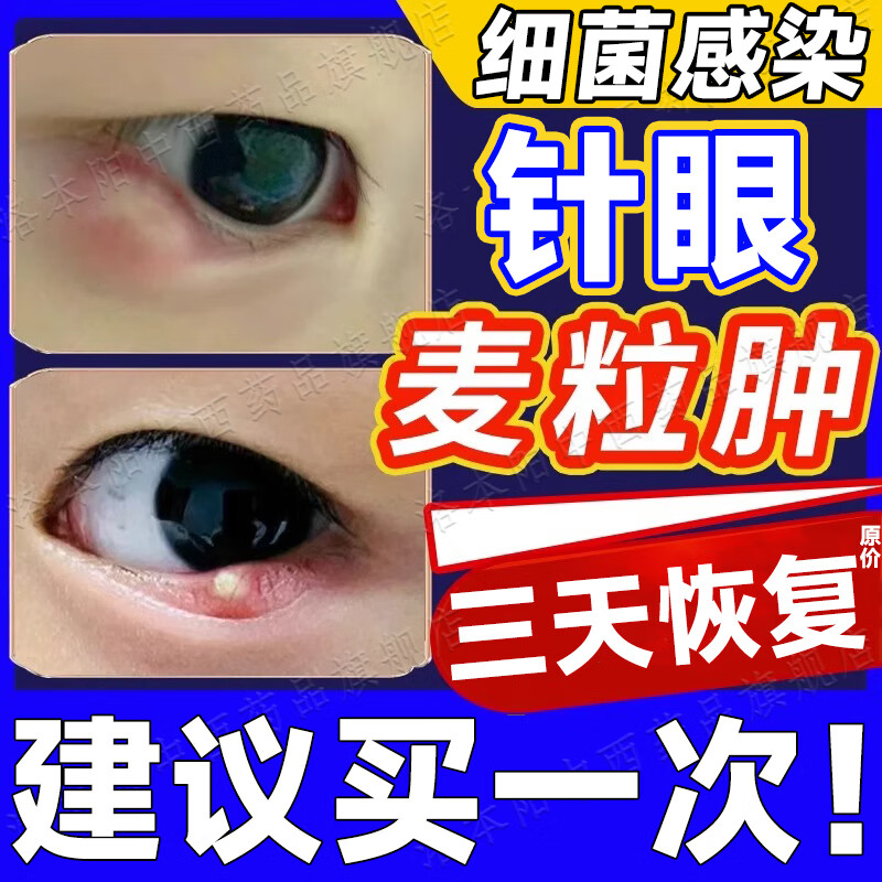 麦粒肿眼膏 治眼睛不舒服红肿痒细菌性结膜炎眼睛细菌感染眼睛红肿