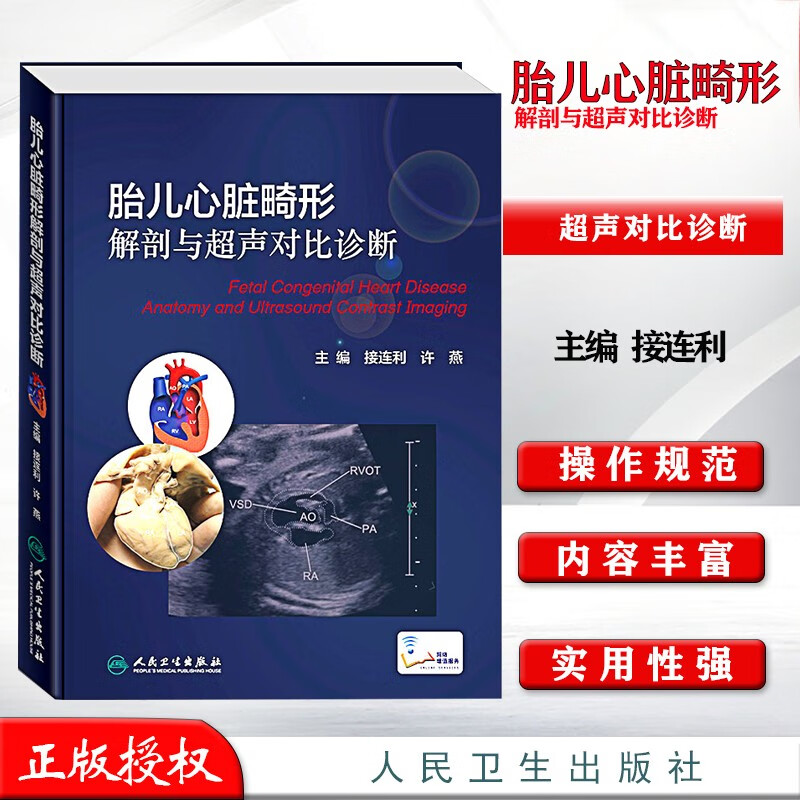 胎儿心脏畸形解剖与超声对比诊断 胎儿 超声 胎儿超声心动图 先天性