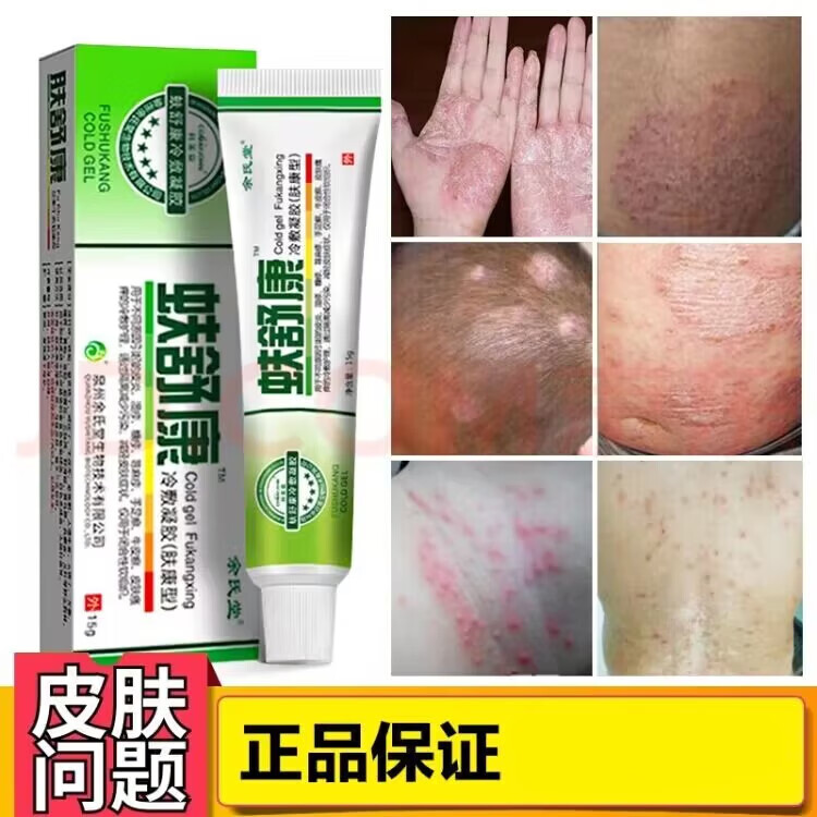 余氏堂肤舒康湿l疹股手足牛l皮l癣汗l疱l疹除肛门瘙痒皮肤瘙痒成人痒