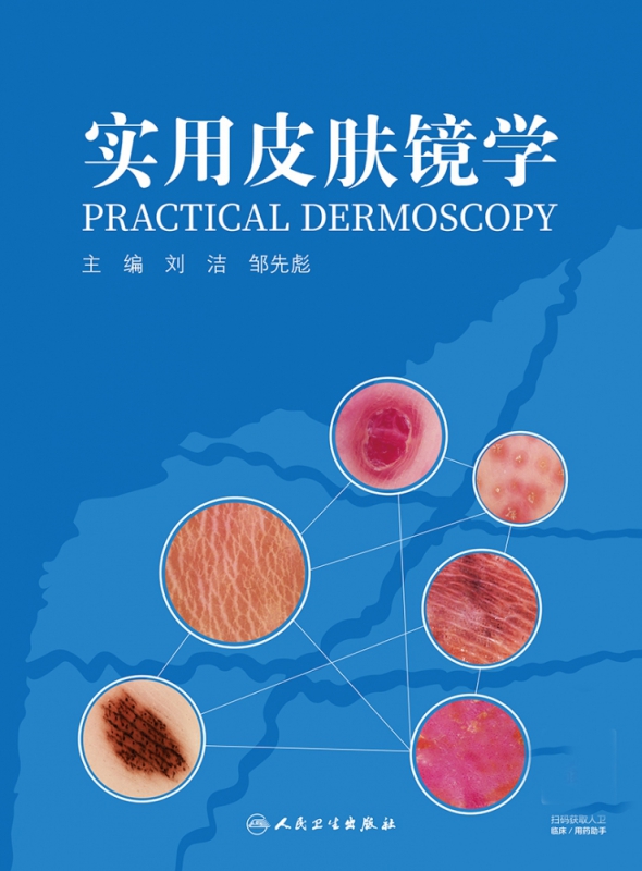 实用皮肤镜学 刘洁,邹先彪