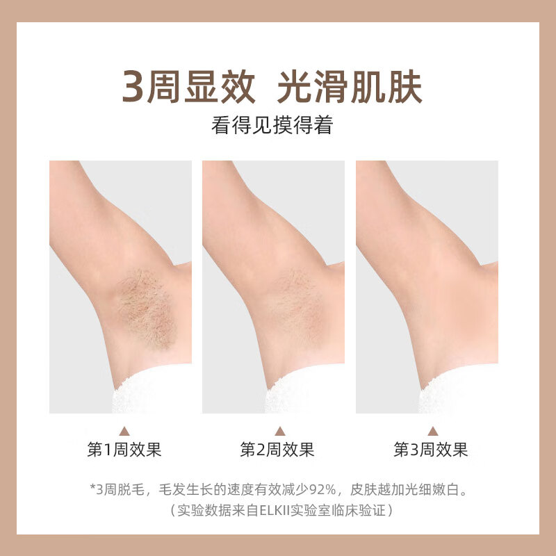 ELLKII 艾珂丽脱毛仪  家用冰点嫩肤 全身腿毛腋下脸部唇毛边冰边脱
