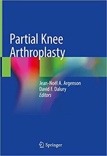 预订Partial Knee Arthroplasty