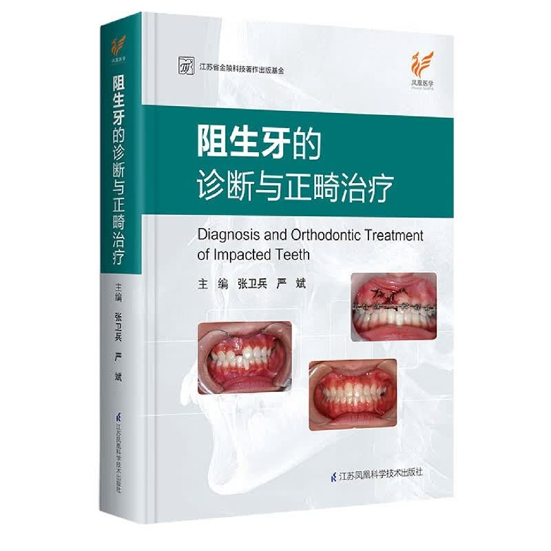 阻生牙的诊断与正畸治疗(精)