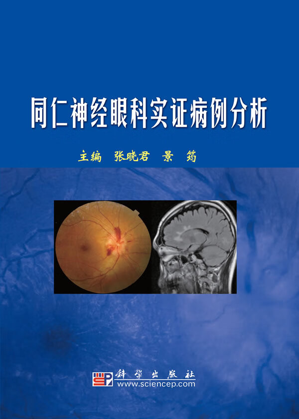 同仁神经眼科实证病例分析【正版图书】