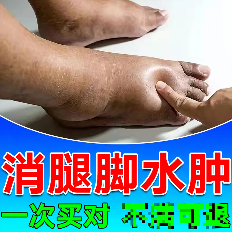 消除水肿消除湿水肿神器脚肿穿不上鞋腿肿面部下肢浮肿消肿贴 水 水肿