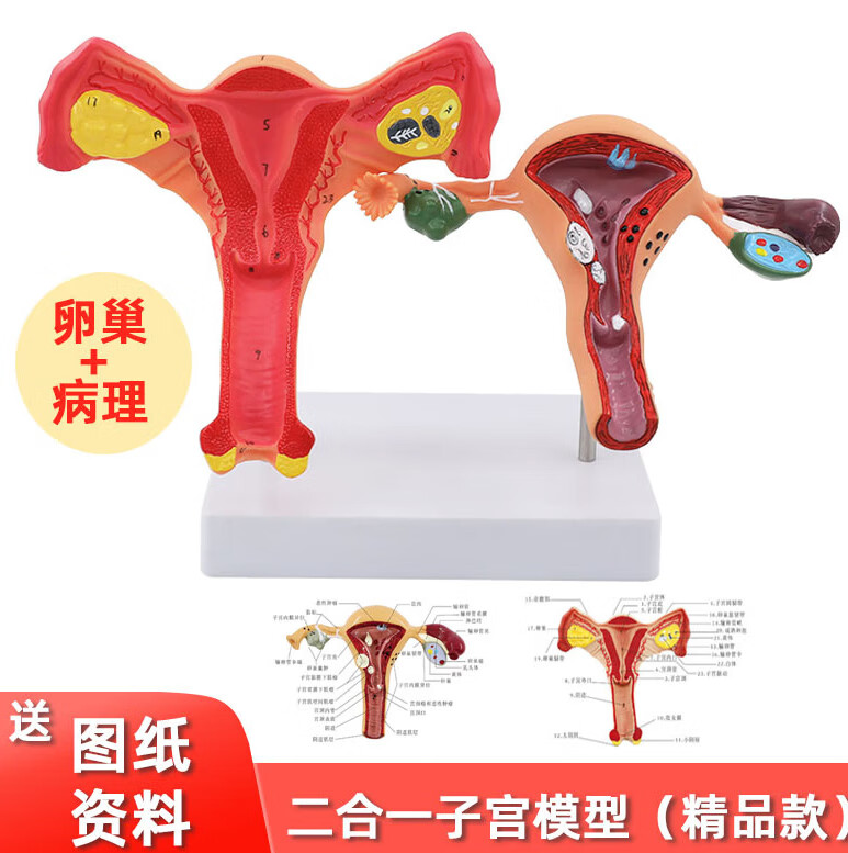 人体女性生殖子宫解剖病理模型阴道卵巢教学模型妇科生殖科教具 精品
