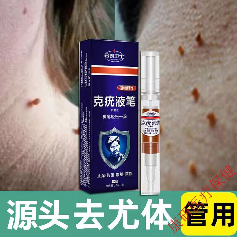 克疣笔克疣液扁平疣脸部疣瘊平除l疣立净去猴子肉粒去刺猴丝状疣脖子