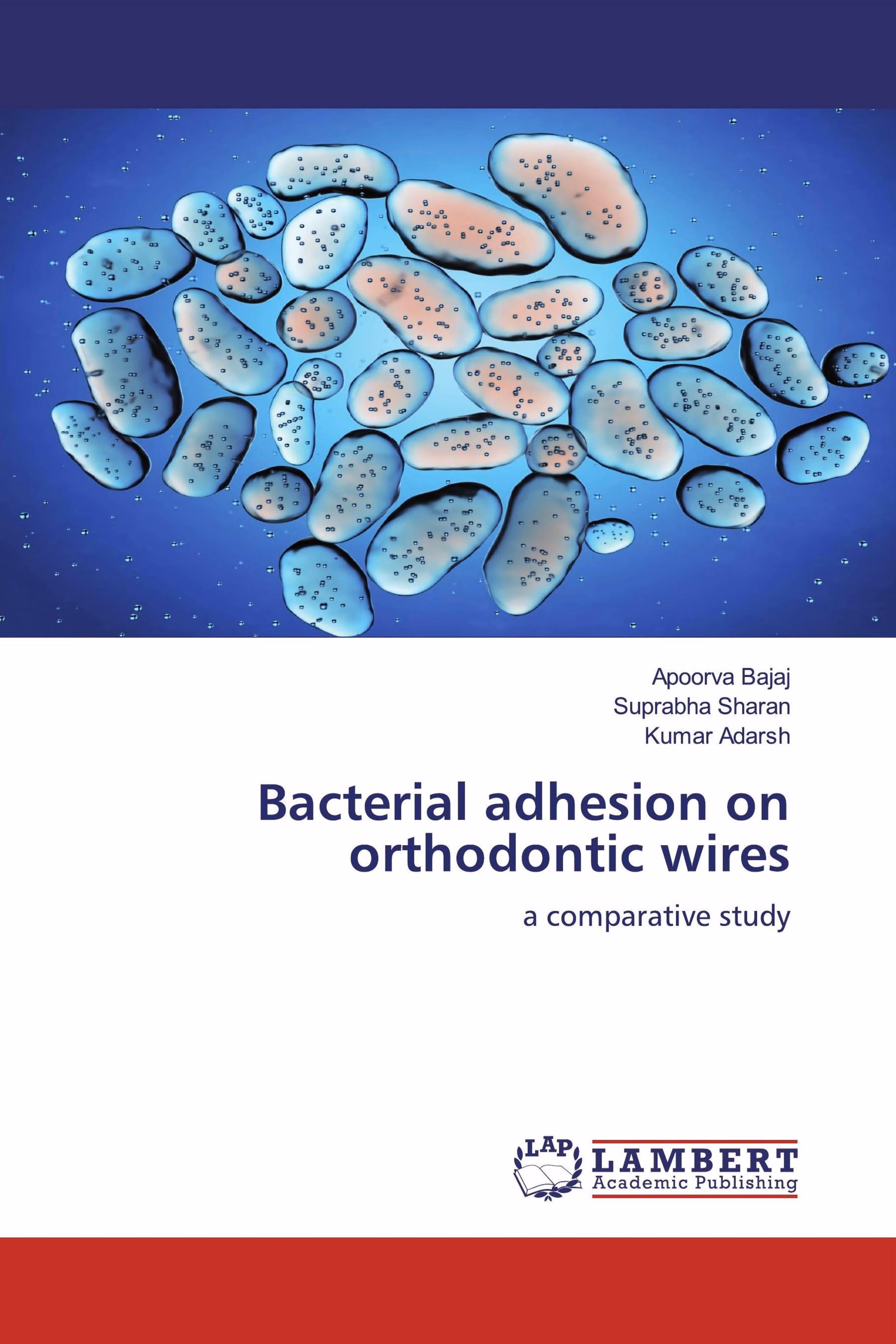 预订Bacterial adhesion on orthodontic wires