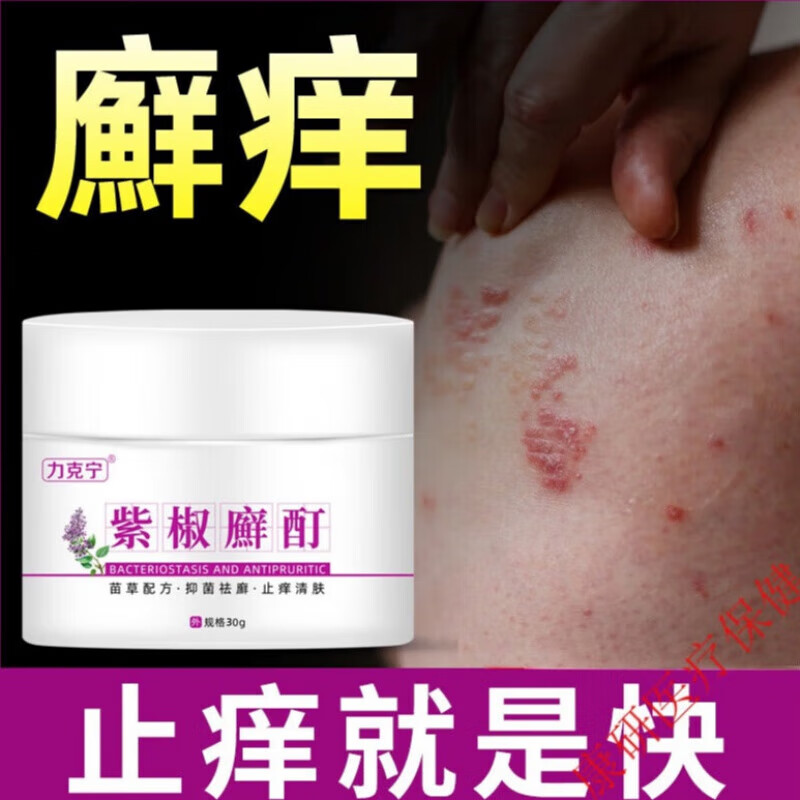 紫椒廯酊癣痒净湿毒清皮肤瘙痒外用膏顽固藓手足体股癣荨麻痒疹癣立净