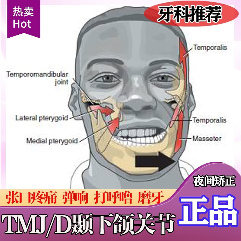 丽跃颞下颌关节紊乱矫正器下巴后缩大小脸偏颌弹响地包天颌垫张口疼痛