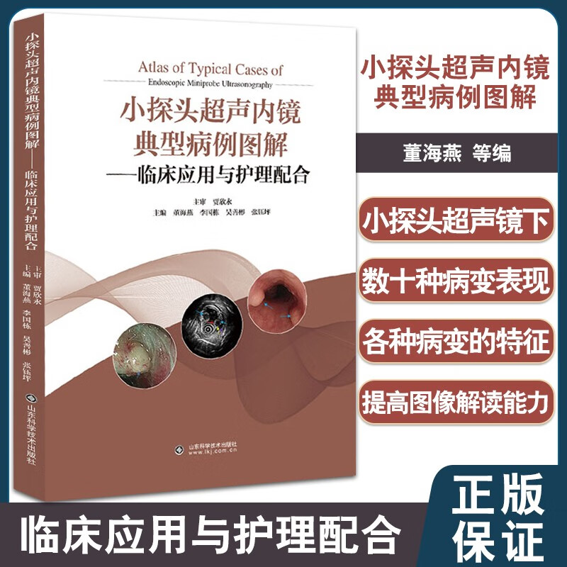 小探头超声内镜典型病例图解临床应用与护理配合 小探头超声内镜图像识别病变图谱书 小探头超声内镜操作技术指导书 医疗超声内镜器械清洗养护指南 内科检查器械书 内科超声影像学 临床医学使用感如何?