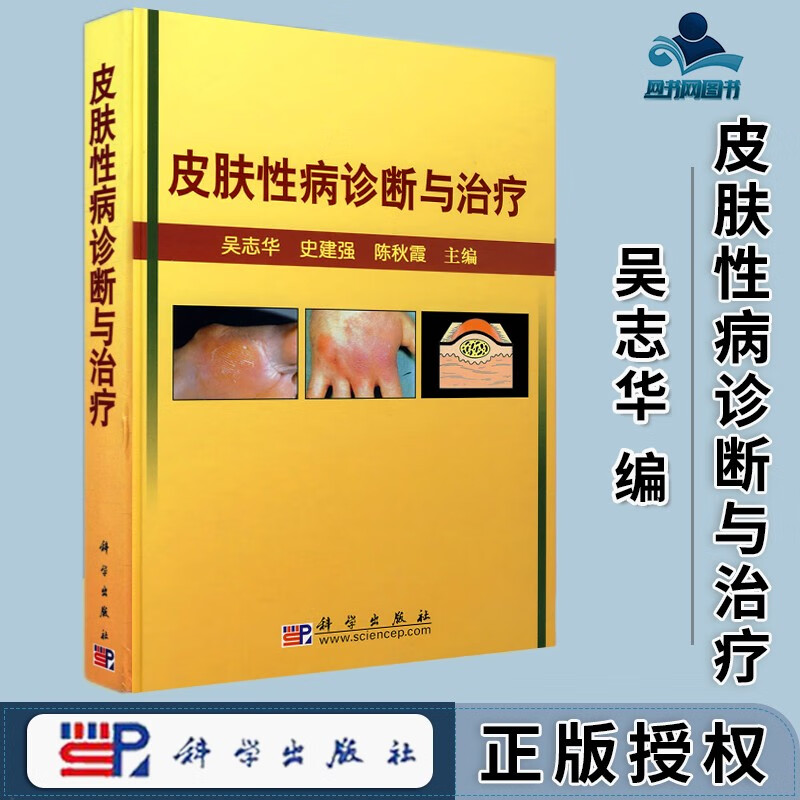 包邮 皮肤性病诊断与治疗 吴志华 史建强 科学出版社