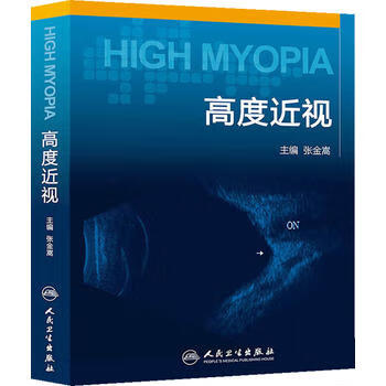 高度近视