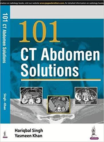 预订101 ct abdomen solutions