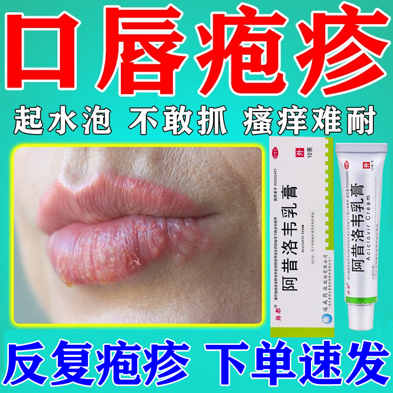 口唇疱疹 嘴唇疱疹起泡烂嘴角起水泡嘴巴脓疮上火嘴角疱疹上火 单纯
