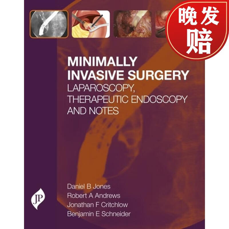 【4周达】minimally invasive surgery : laparoscopy, therapeutic