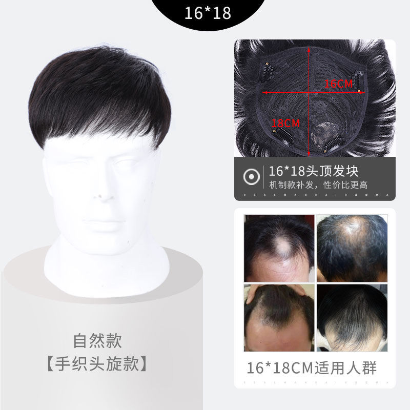 唐妮  男士假发男短发帅气韩版头顶补发片男假发片秃顶前额男式真发