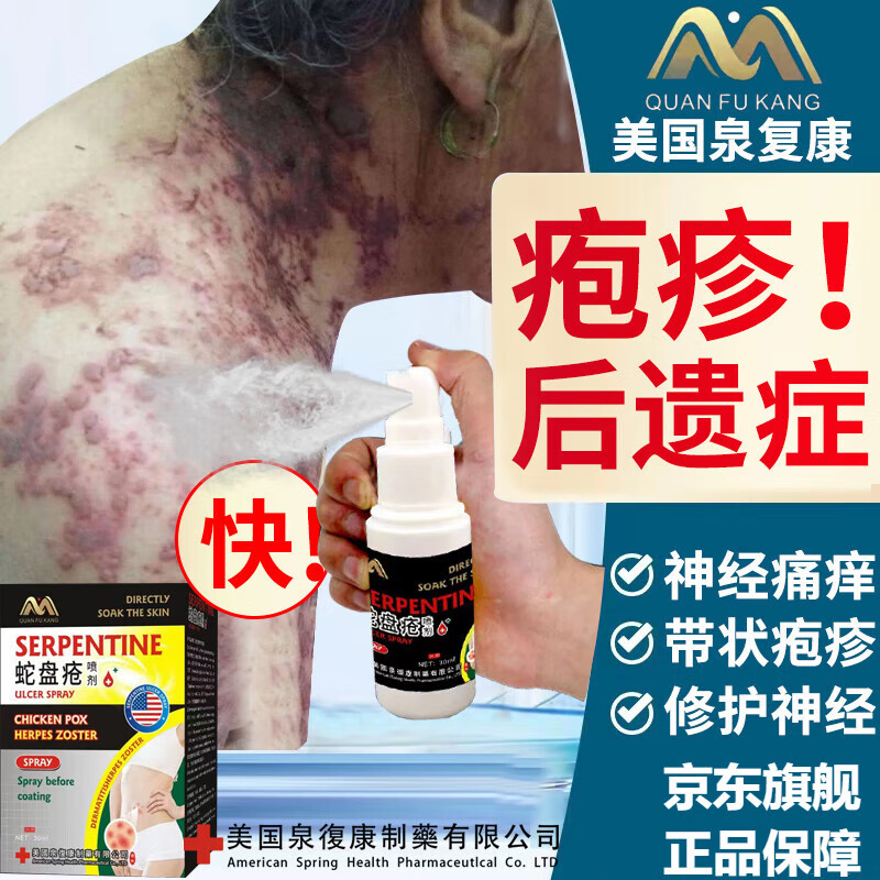 佰束后遗神经肽泡疹后遗疹神经痛外用喷剂带状疱包疹后遗症蛇盘清宁