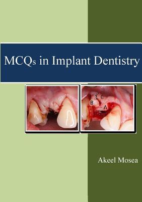 预订MCQs in Implant Dentistry