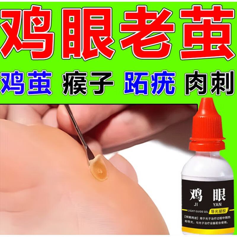 跖疣干扰素凝胶寻常疣脚底跖疣老茧死皮瘊子肉刺根足部贴液脚手部跖
