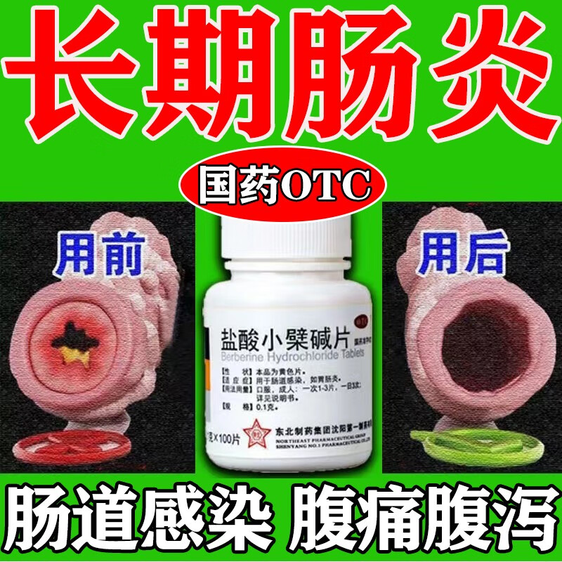 【肠炎吃什么药】盐酸小檗碱片慢性肠炎肠道感染急性肠炎肠胃炎腹痛