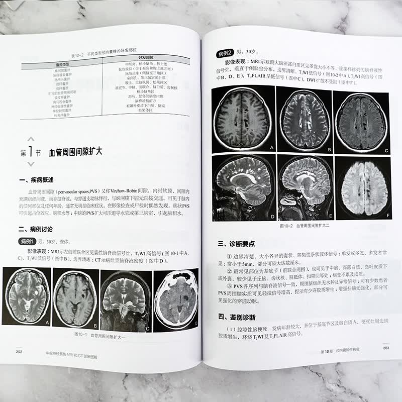 中枢神经系统MRI和CT诊断图解